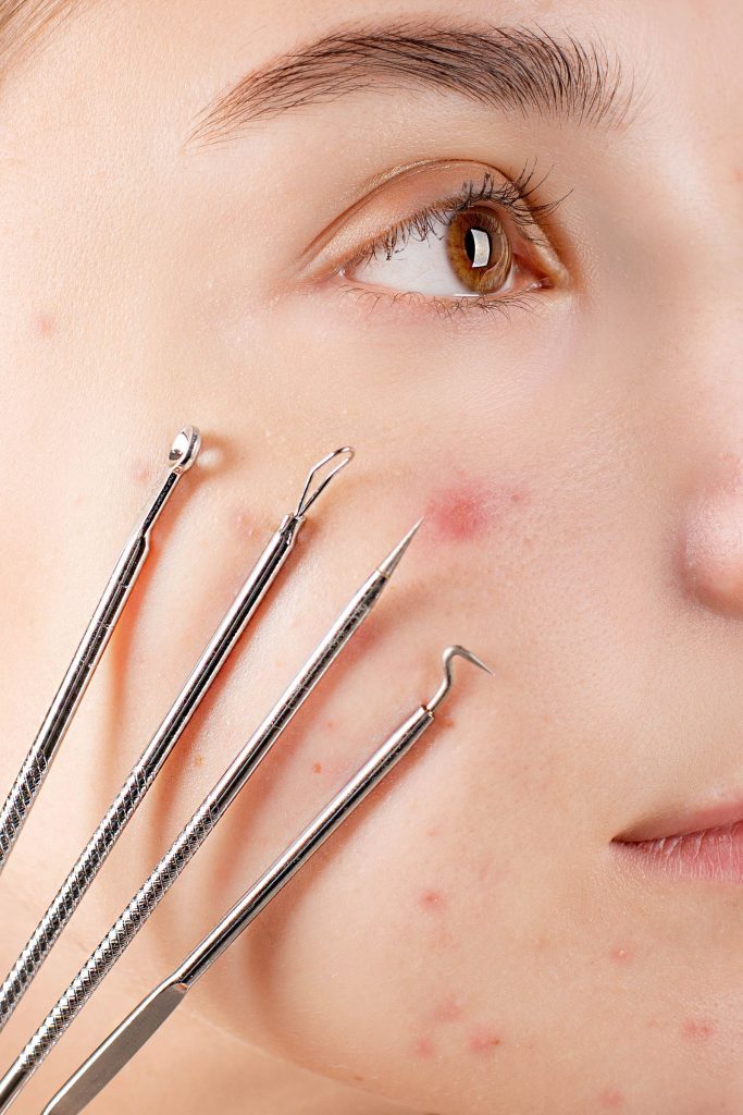 Close-up of skin extraction tools used in dermatological treatment